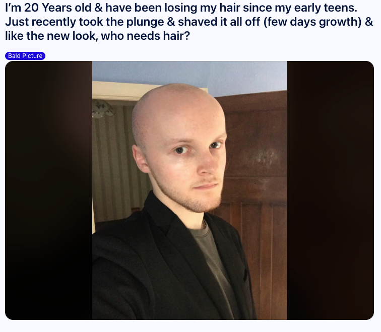 Young man experiencing early hair loss